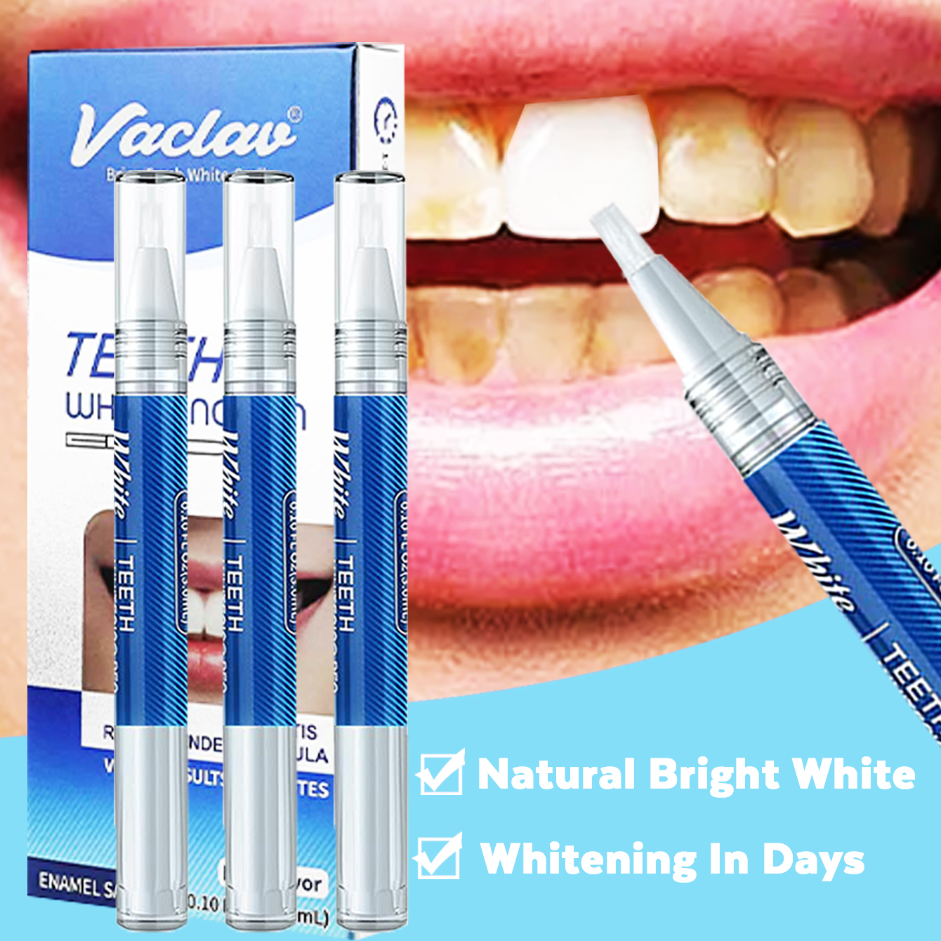 Whitening Pen Bleach - Vaclav Teeth Whitening Pen Tooth Whitening