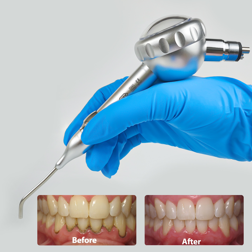 Dental Air Prophy Handpiece Un - Colgate Whitening Teeth recensie en prijs