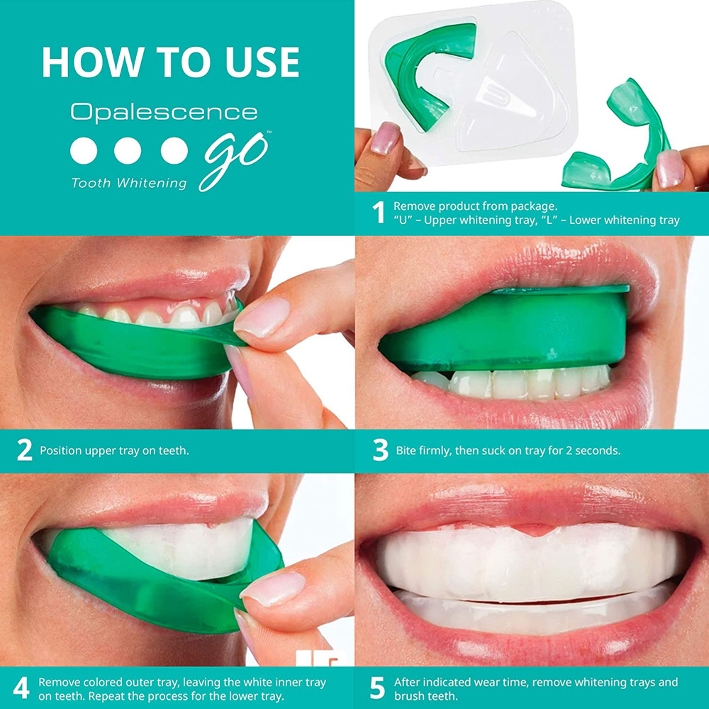 Hydrogen Peroxide For Teeth Wh - Teeth Whitening Opalescence recensie en prijs