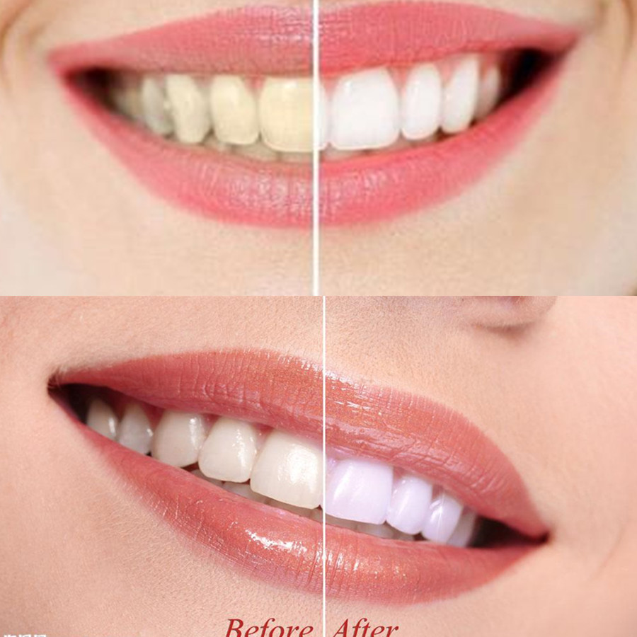 Bamboo Charcoal Teeth Tooth De - Teeth Whitening Charcoal recensie en prijs