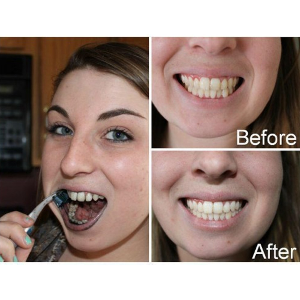 Bamboo Charcoal Teeth Tooth De - Teeth Whitening Charcoal recensie en prijs