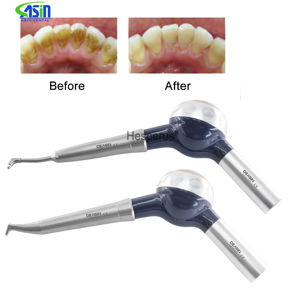 Teeth Whitening Spray Dental A - Colgate Whitening Teeth recensie en prijs