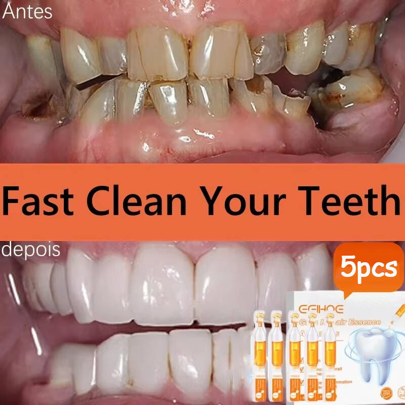 Quickly Repair Gum Serum Relie - Teeth Whitening With Baking Soda recensie en prijs