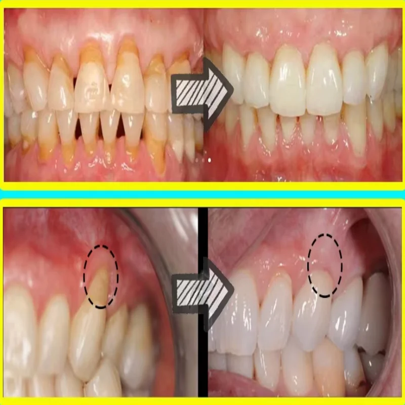 Quickly Repair Gum Serum Relie - Teeth Whitening With Baking Soda recensie en prijs