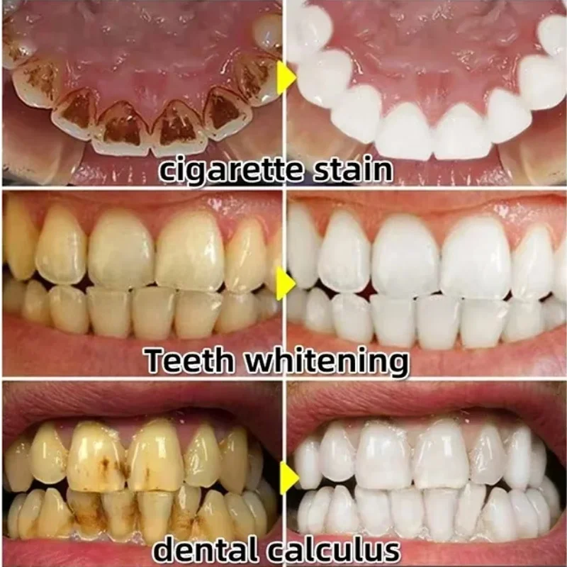 Quickly Repair Gum Serum Relie - Teeth Whitening With Baking Soda recensie en prijs