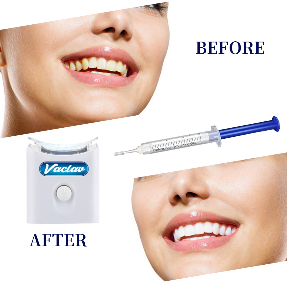 Mint Teeth Whitening Gel Syrin - Teeth Whitening With Baking Soda recensie en prijs