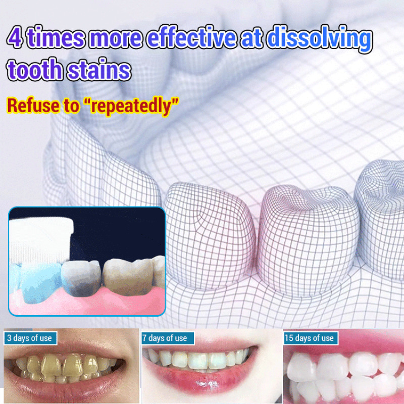 Baking Soda Whiten Teeth Fresh - Teeth Whitening With Baking Soda recensie en prijs