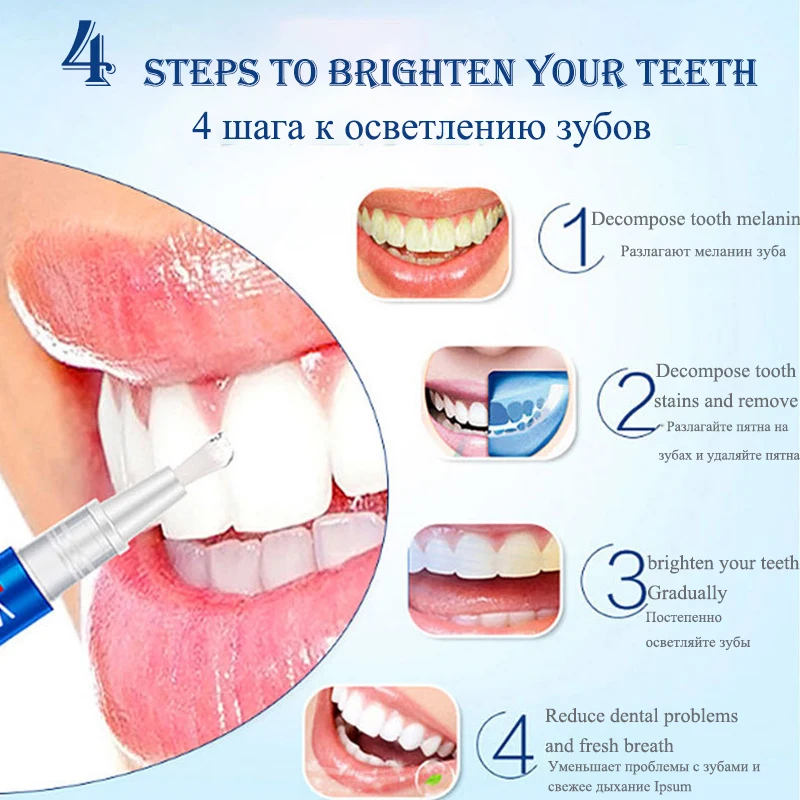 Teeth Whitening Pen Tooth Gel  - Whitening Pen Bleach recensie en prijs