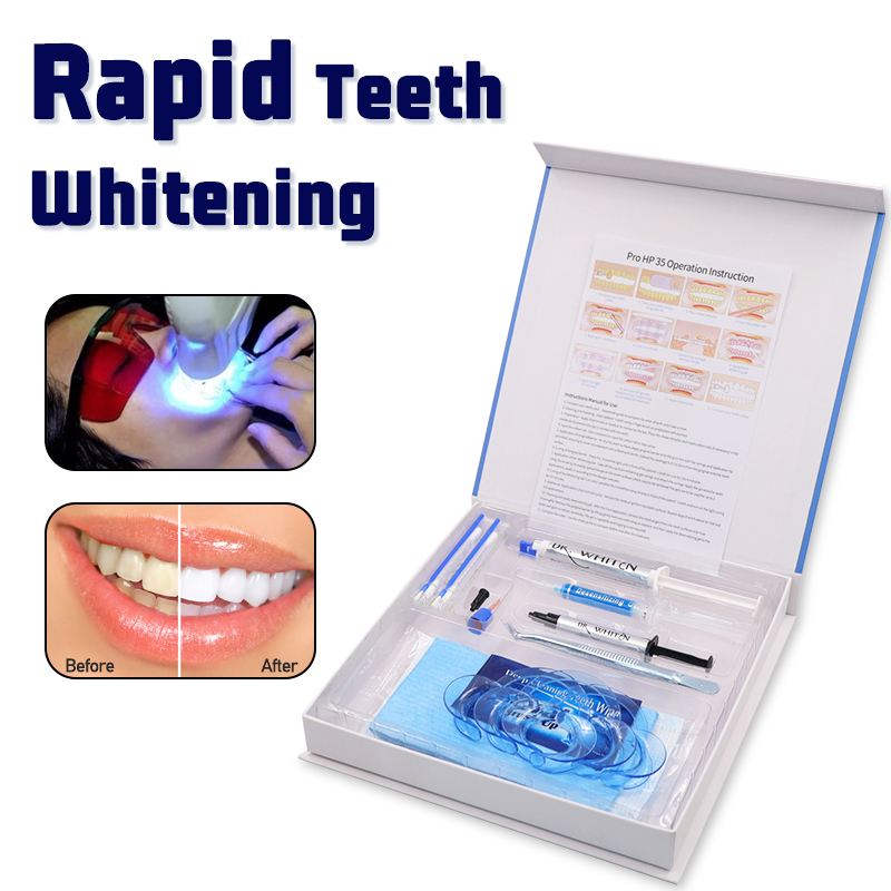 Professional Teeth Whitening K - Teeth Whitening Opalescence recensie en prijs