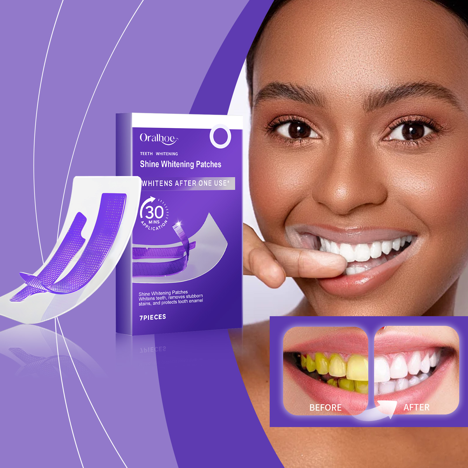 Purple Teeth Whitening Strips  - Teeth Whitening Street recensie en prijs