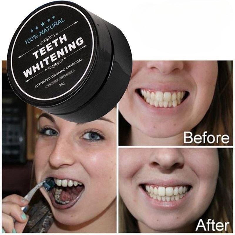 1 Box Activated Charcoal Teeth - Teeth Whitening Charcoal recensie en prijs