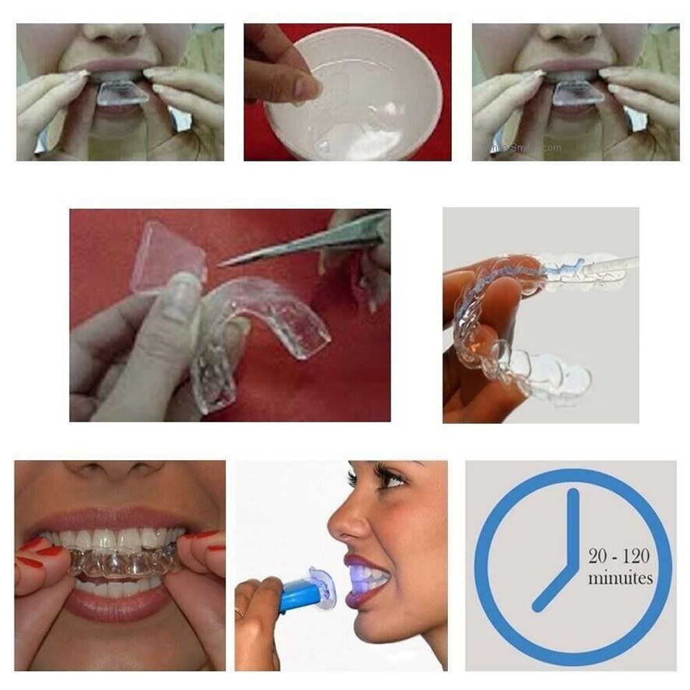 Silicone Night Mouth Guard Too - Dental Guard Night recensie en prijs