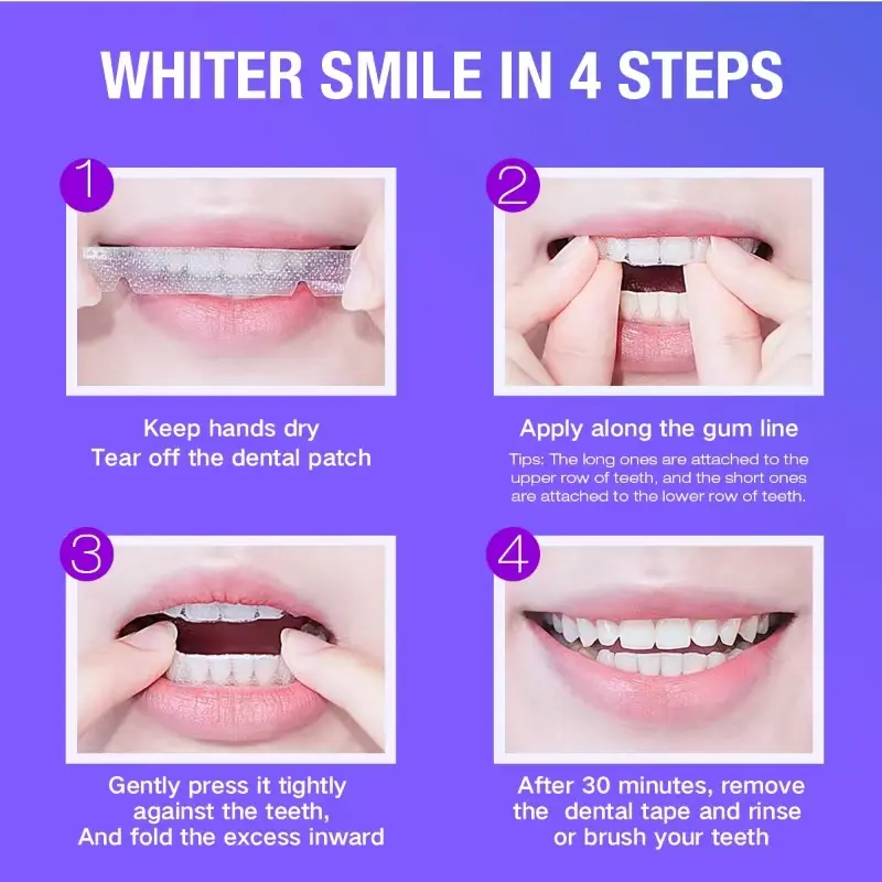 Teeth Whitening Kit - 5X LED L - Teeth Whitening Street recensie en prijs