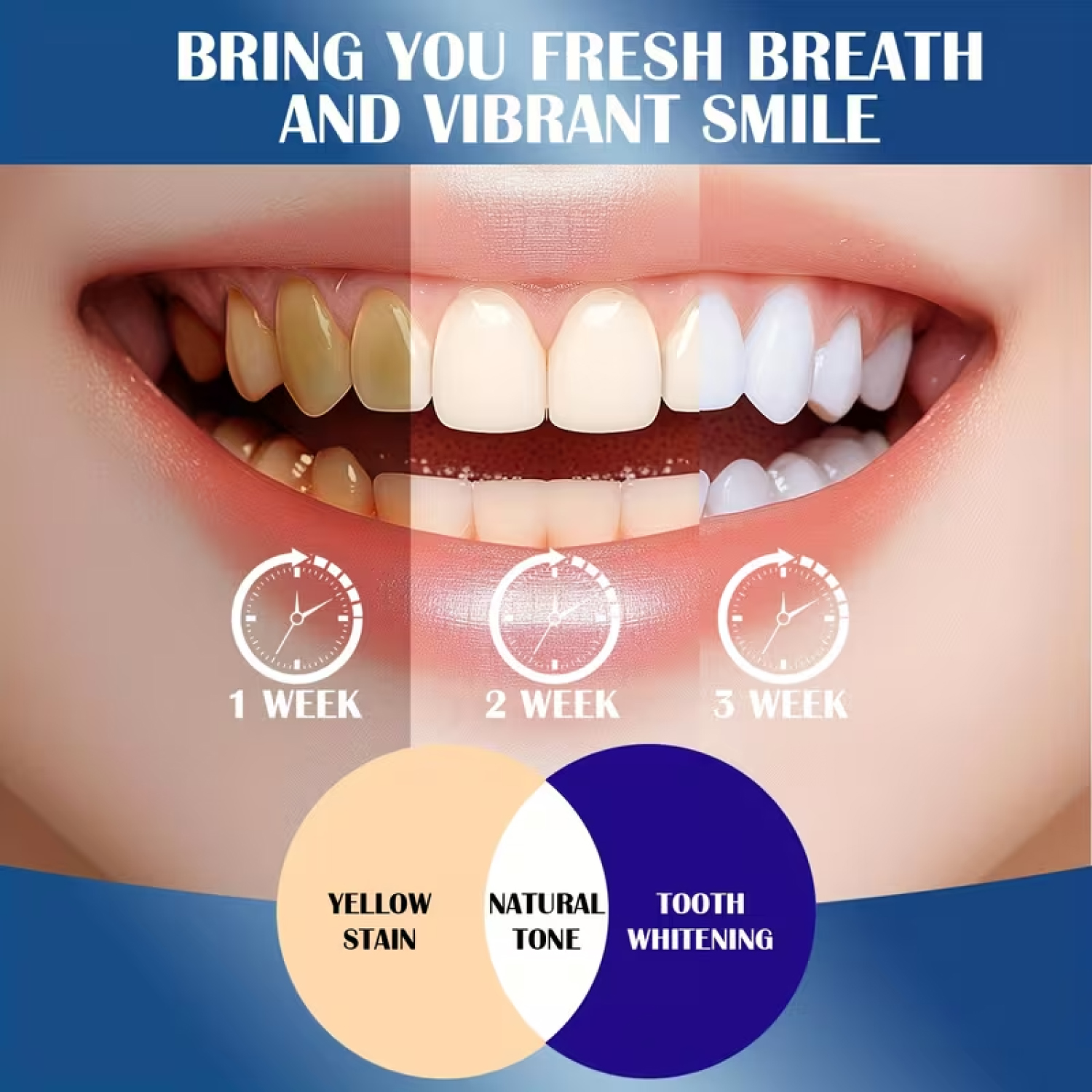 20% Hydroxyapatite Toothpaste. - Teeth Whitening Opalescence recensie en prijs