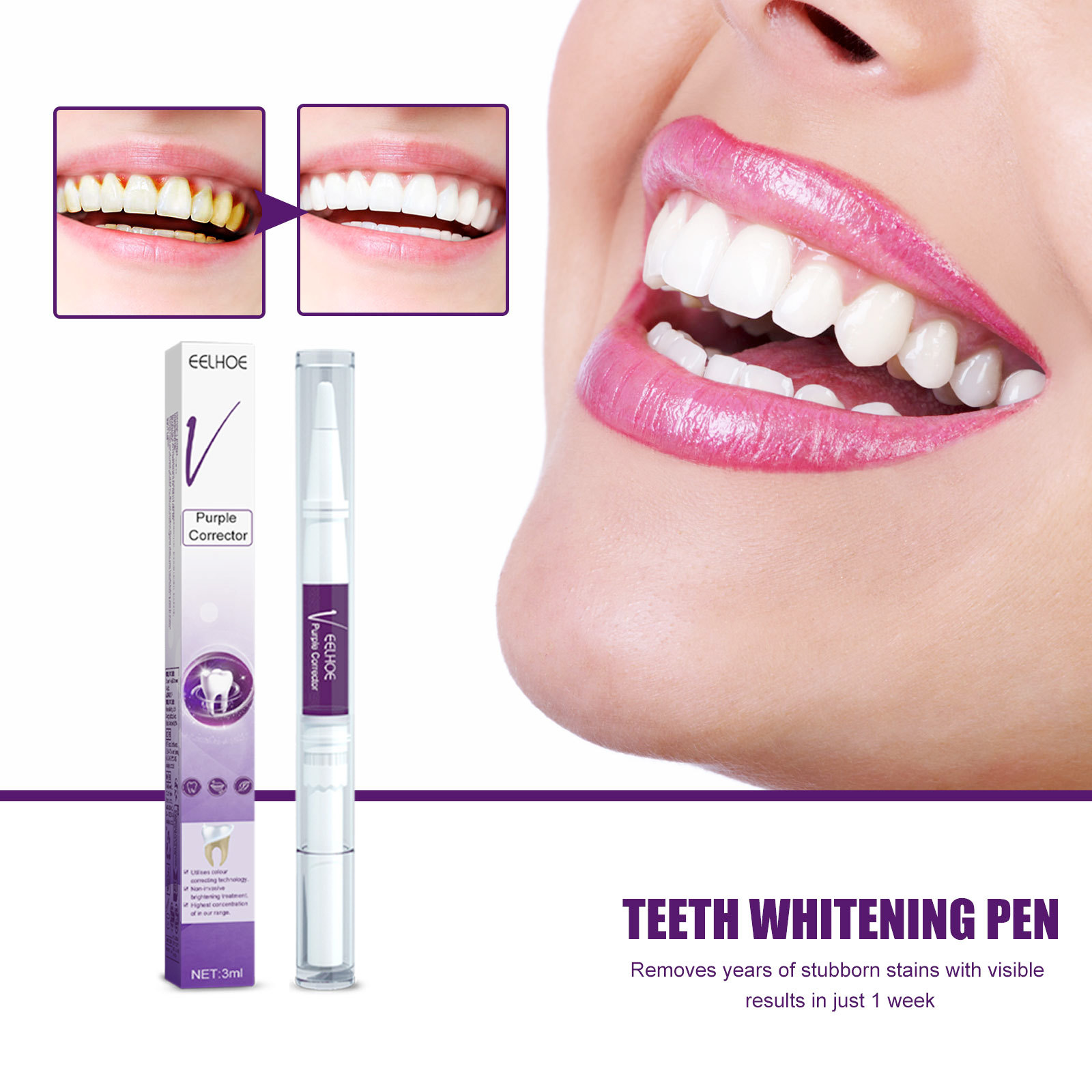 Purple Teeth Whtening Toothpas - Whitening Pen Bleach recensie en prijs