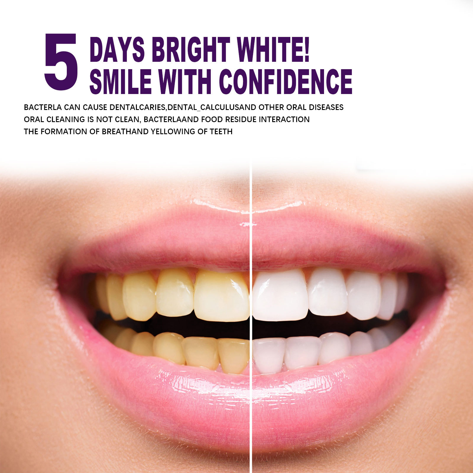 Purple Teeth Whtening Toothpas - Whitening Pen Bleach recensie en prijs