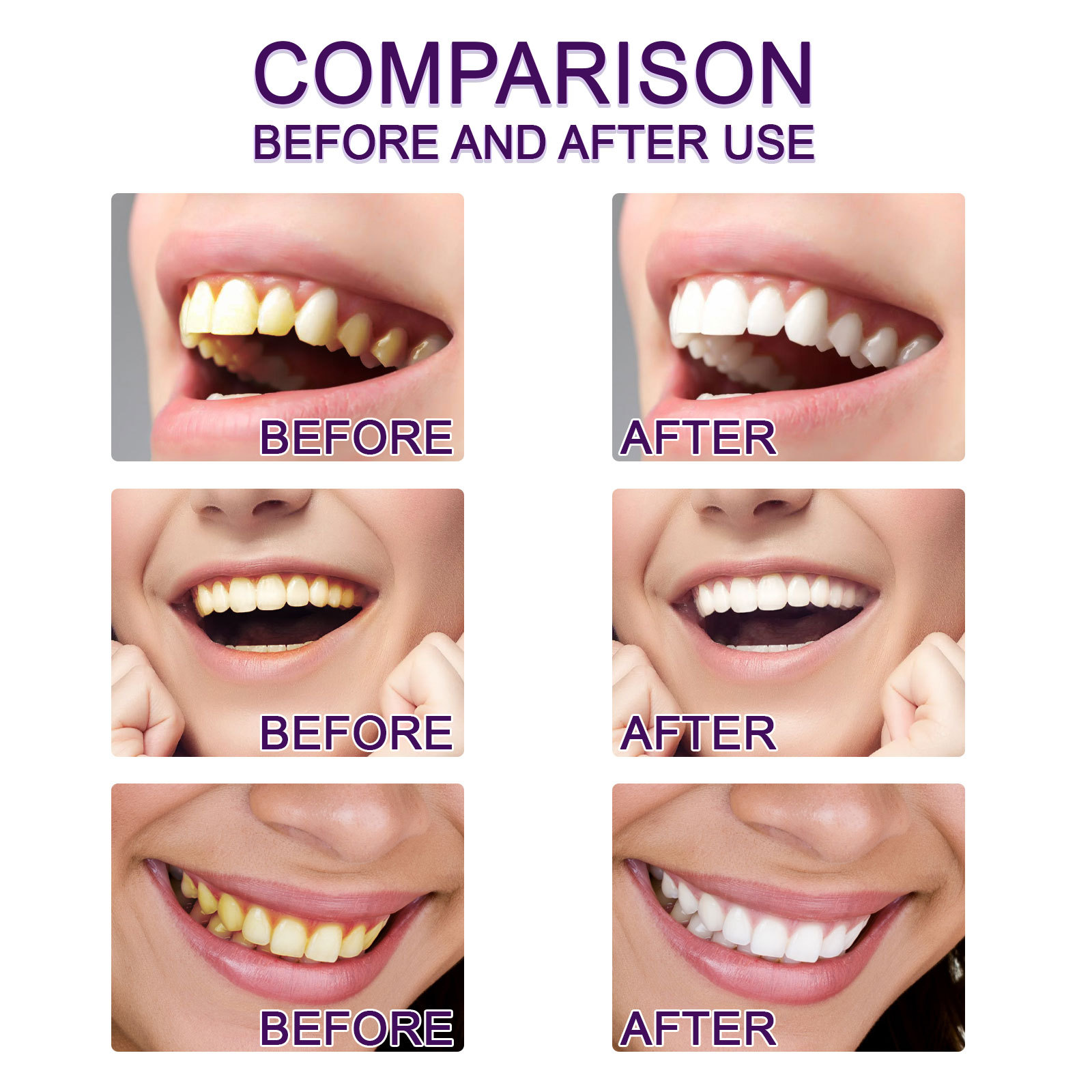 Purple Teeth Whtening Toothpas - Whitening Pen Bleach recensie en prijs