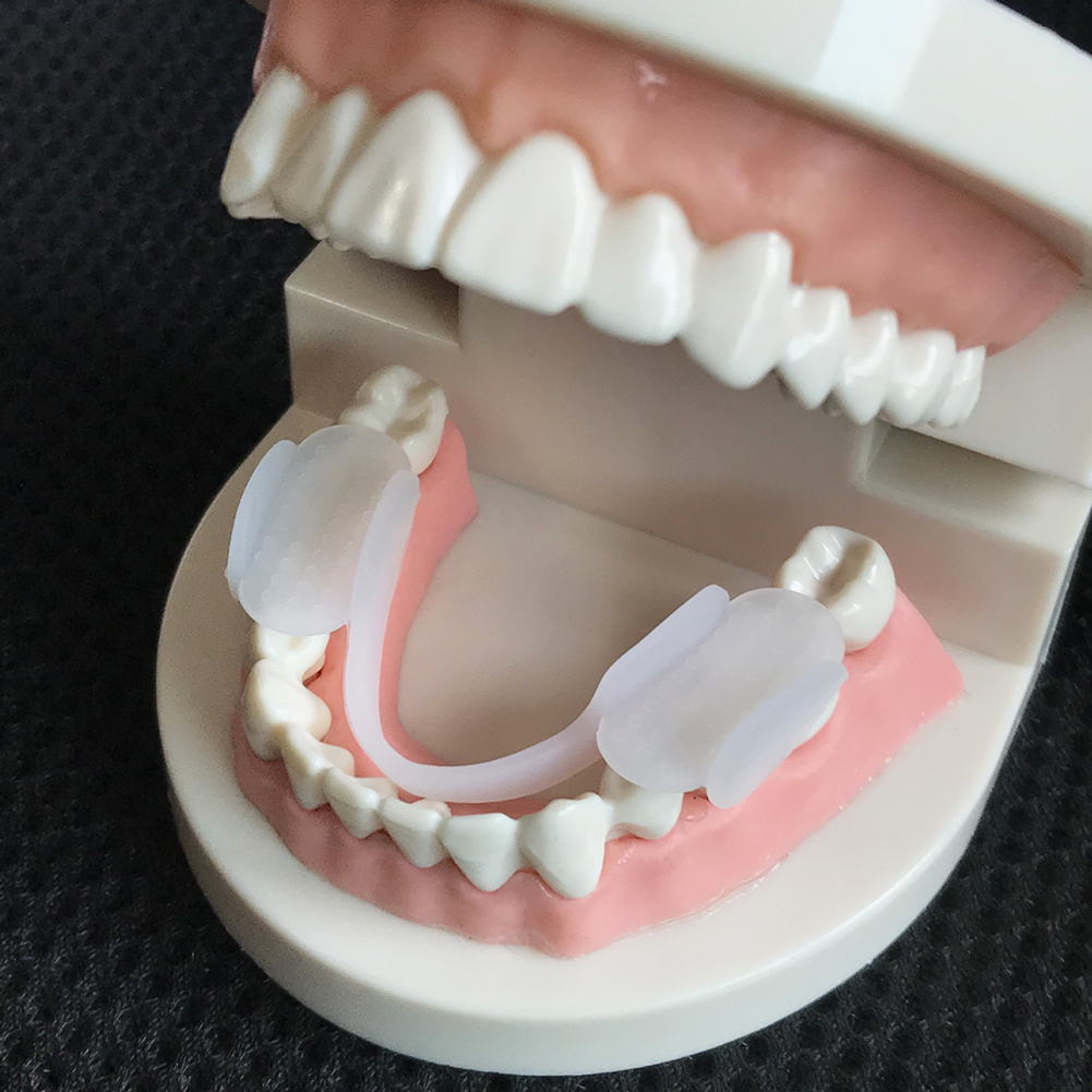 2Pcs Dental Mouth Guard Soft T - Dental Guard Night recensie en prijs