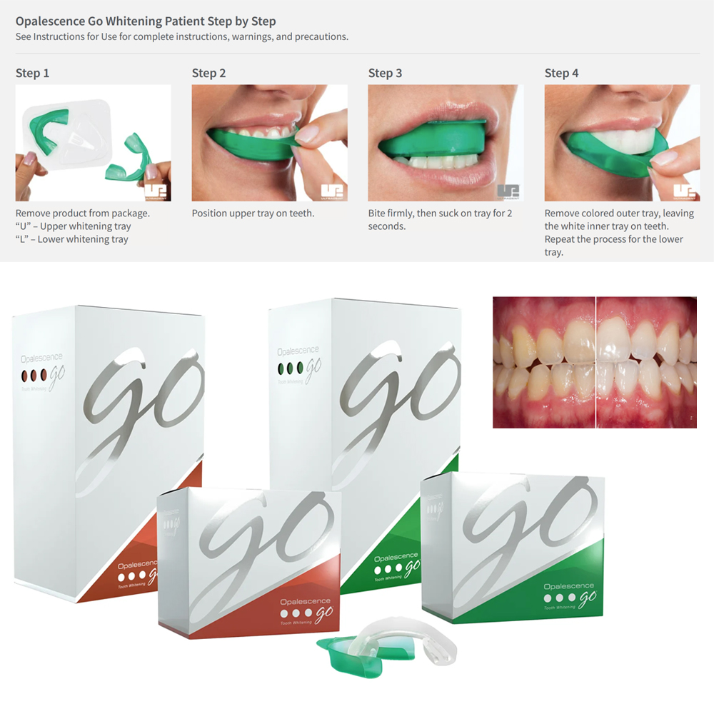 Opalescence Go Teeth Whitening - Teeth Whitening Opalescence recensie en prijs