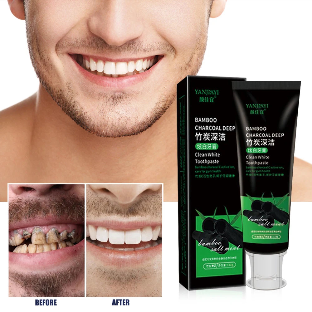 110g Bamboo Charcoal Black Too - Teeth Whitening Charcoal recensie en prijs