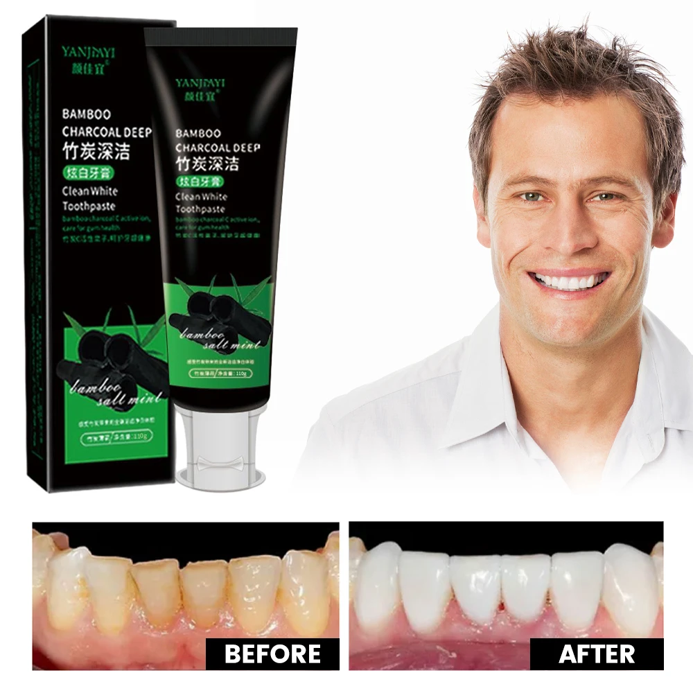 110g Bamboo Charcoal Black Too - Teeth Whitening Charcoal recensie en prijs