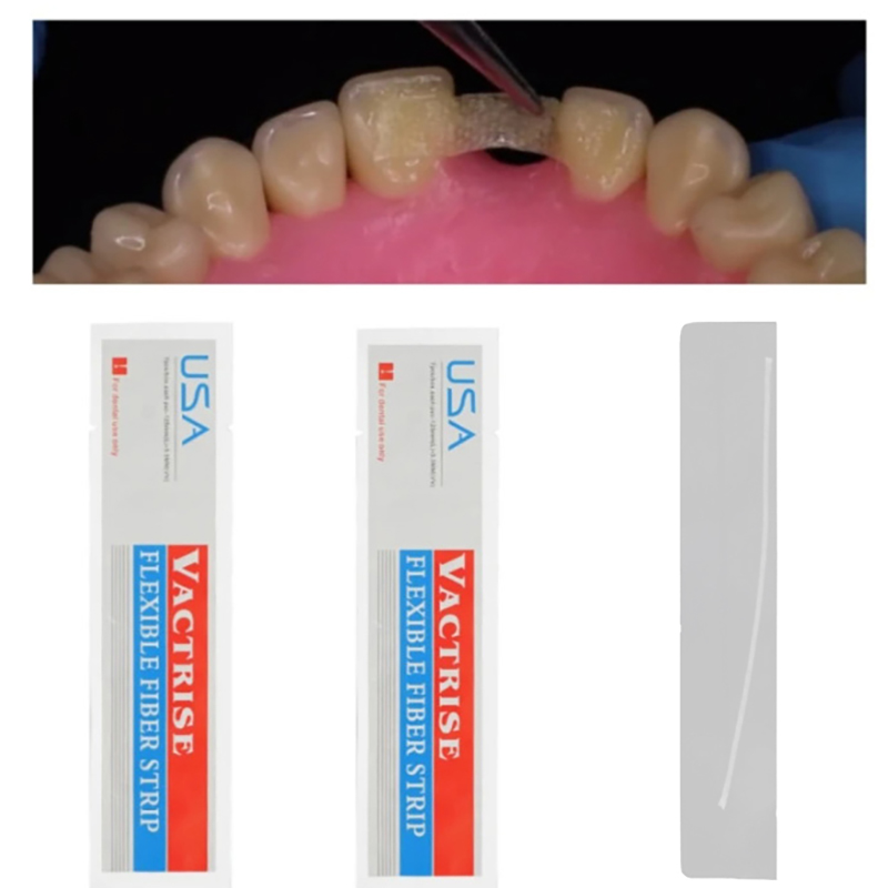 1Pcs Dental Flexible Fiber Str - Teeth Whitening Strips Lumineux recensie en prijs