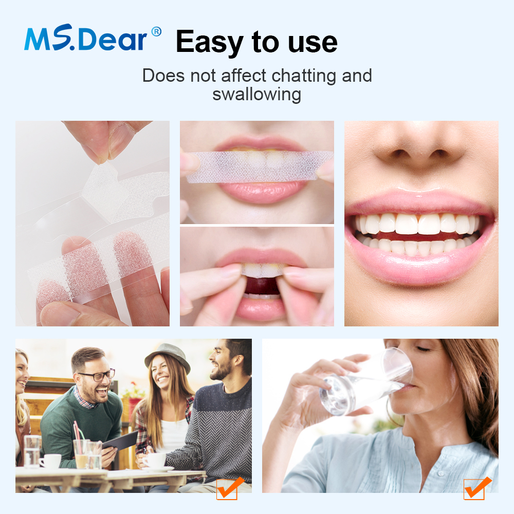 Teeth Whitening Strips Cleansi - Colgate Whitening Teeth recensie en prijs